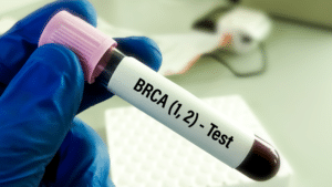BRCA Genes - genetic testing mutation