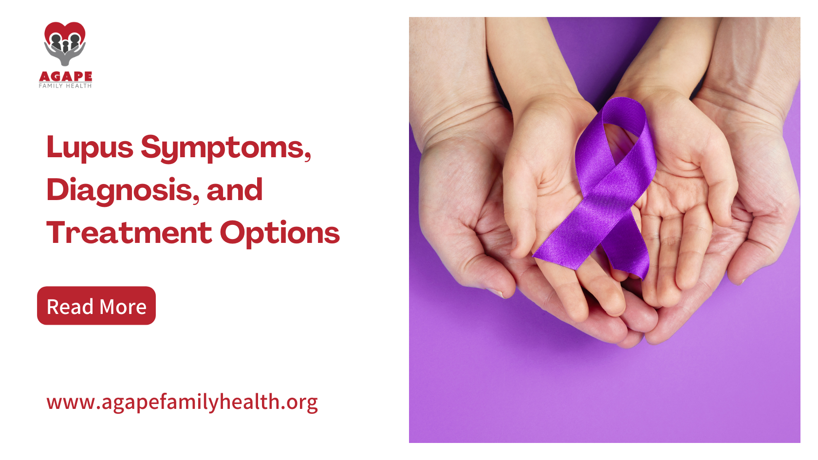 blog banner for Lupus Symptoms, Diagnosis, and Treatment Options