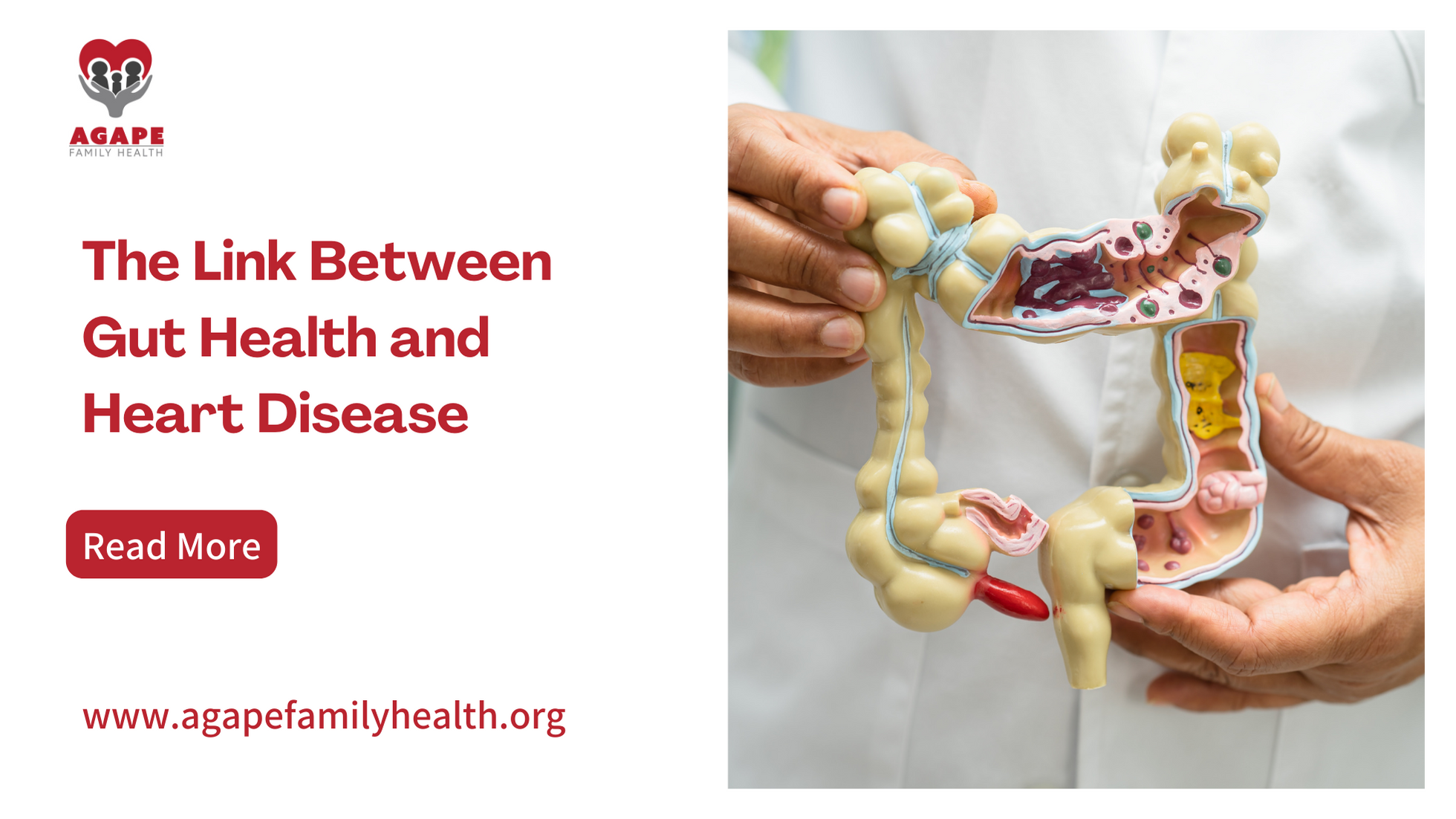 blog banner for The Link Between Gut Health and Heart Disease