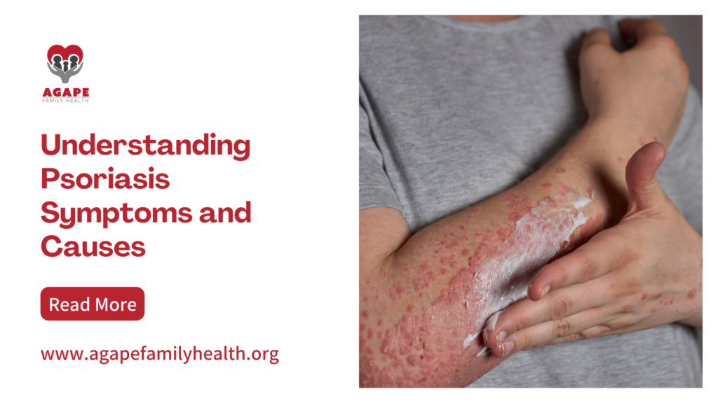 Understanding Psoriasis Symptoms and Causes - Agape Family Health